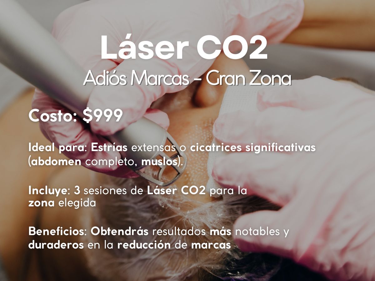 Paquete: Adiós Marcas – Gran Zona