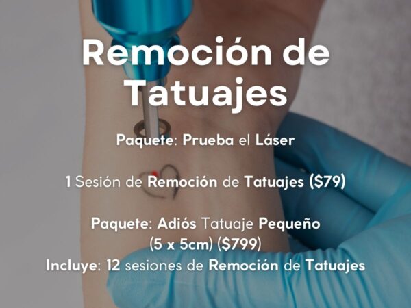 Paquete: Prueba el Láser: 1 Sesión de Remoción de Tatuajes