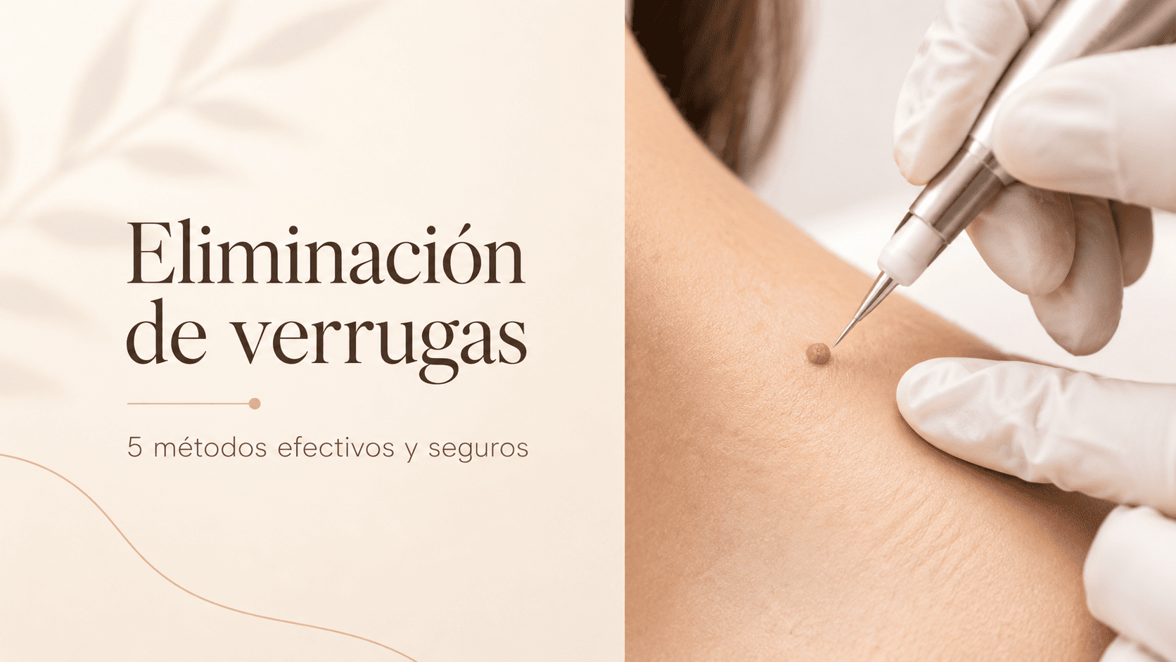 Profesional realizando un procedimiento de eliminación de verrugas con dispositivo de precisión en un entorno clínico