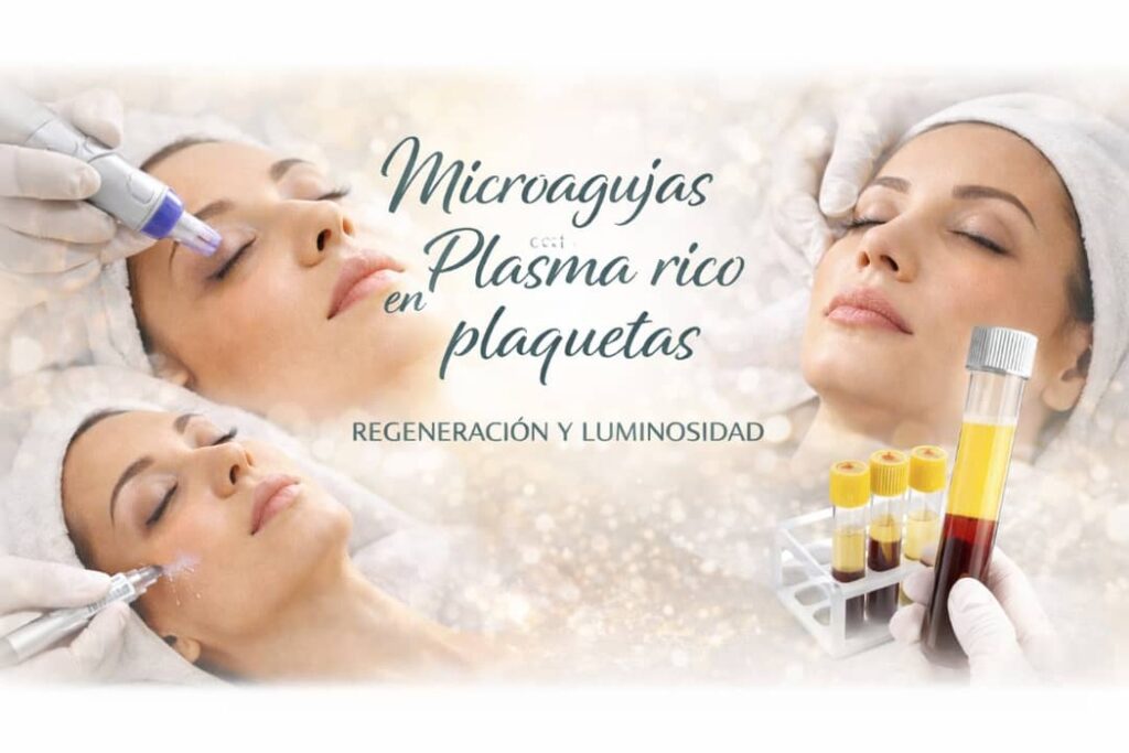 Tratamiento de rejuvenecimiento facial con microagujas y PRP para mejorar la firmeza y textura de la piel