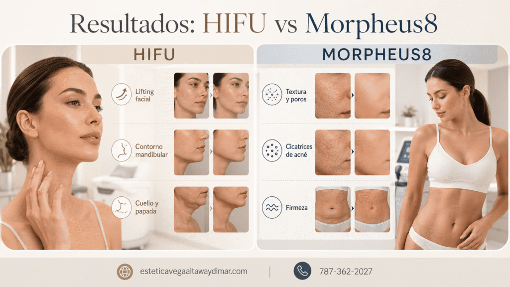 que es mejor HIFU o Morpheus8 segun la piel