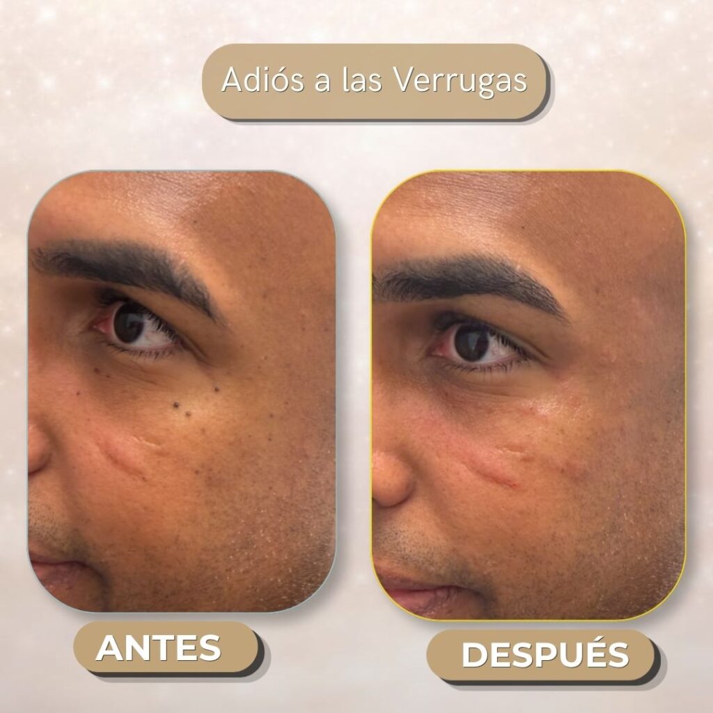 DESPUES 1