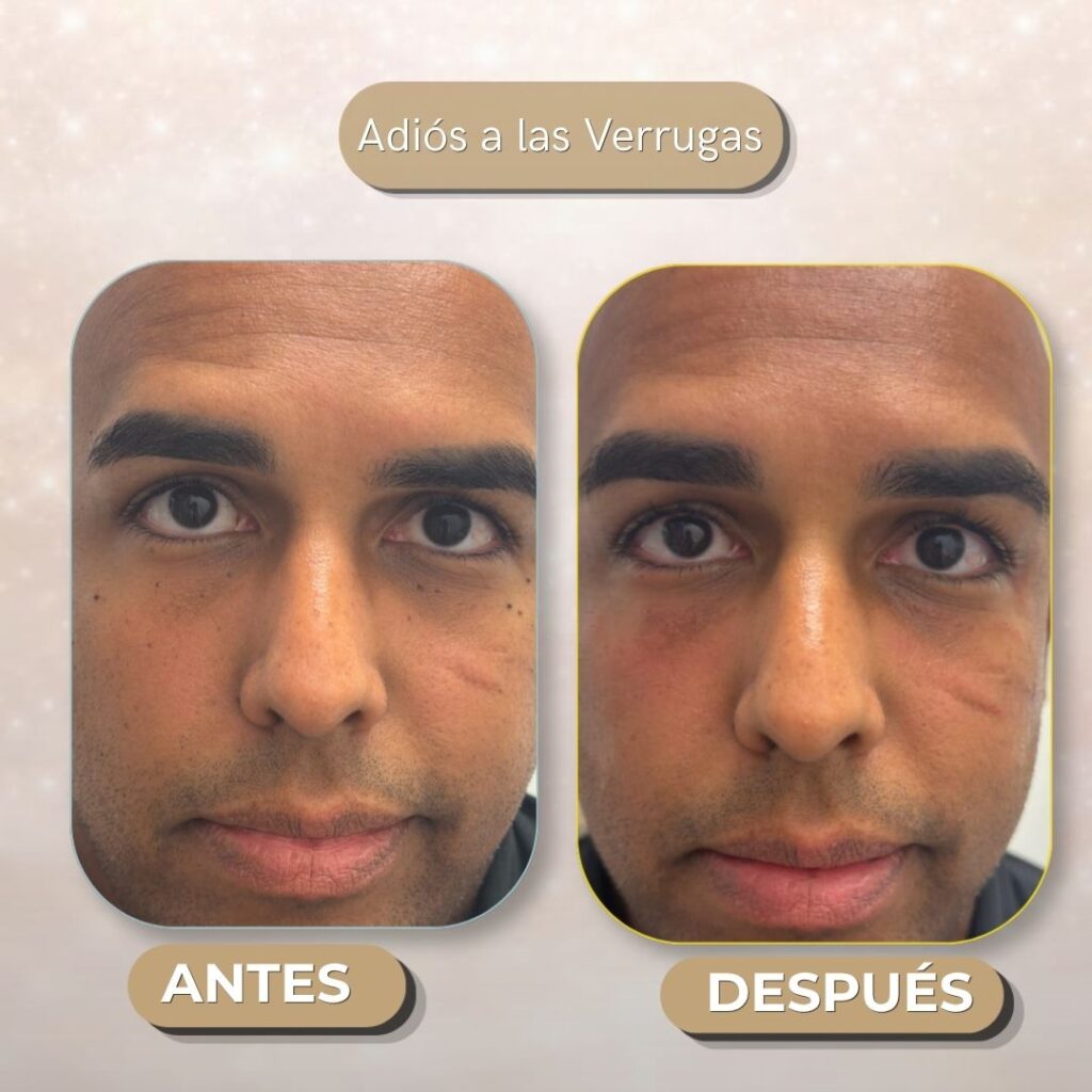 DESPUES